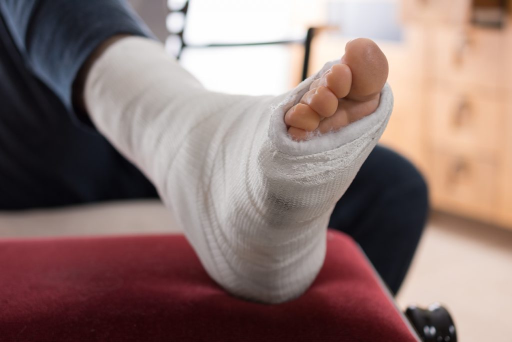 Does Physical Therapy Help Fractures? - Countryside Orthopaedics