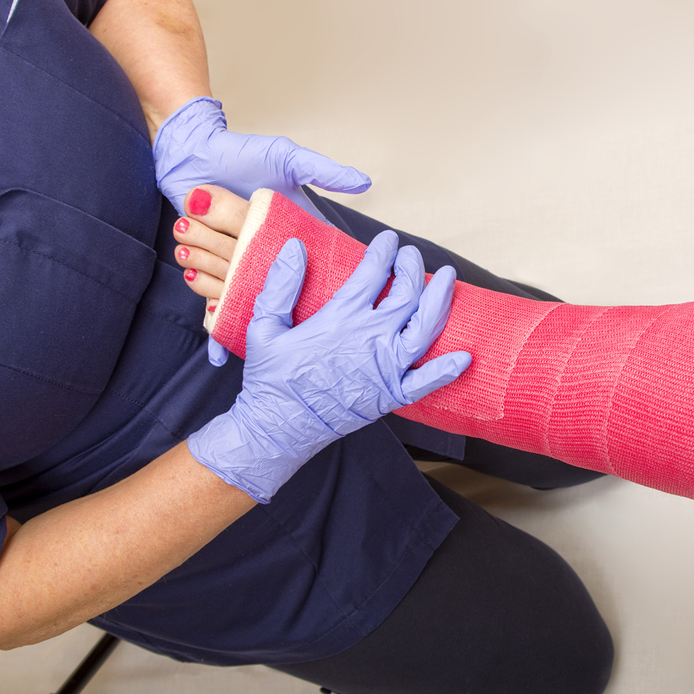Should You Remove Your Own Cast? Find Out Here