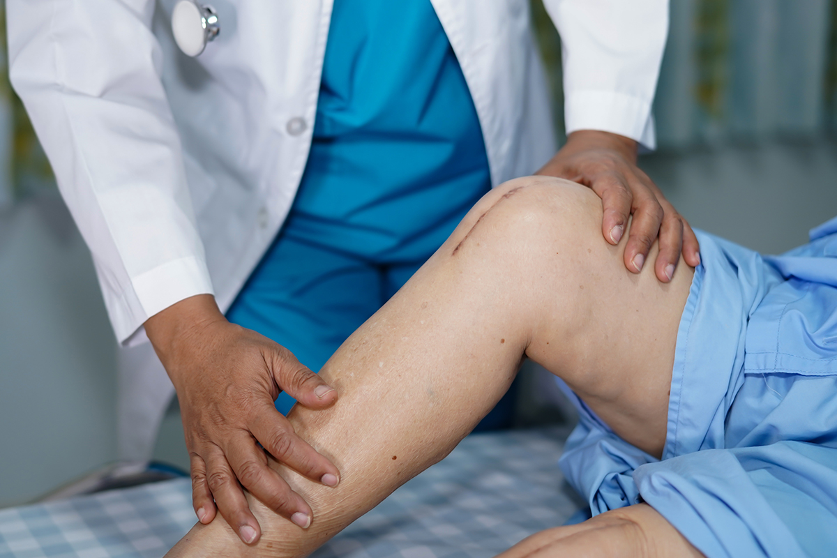 So You Think You Need A Knee Replacement - Southshore Physical Therapy